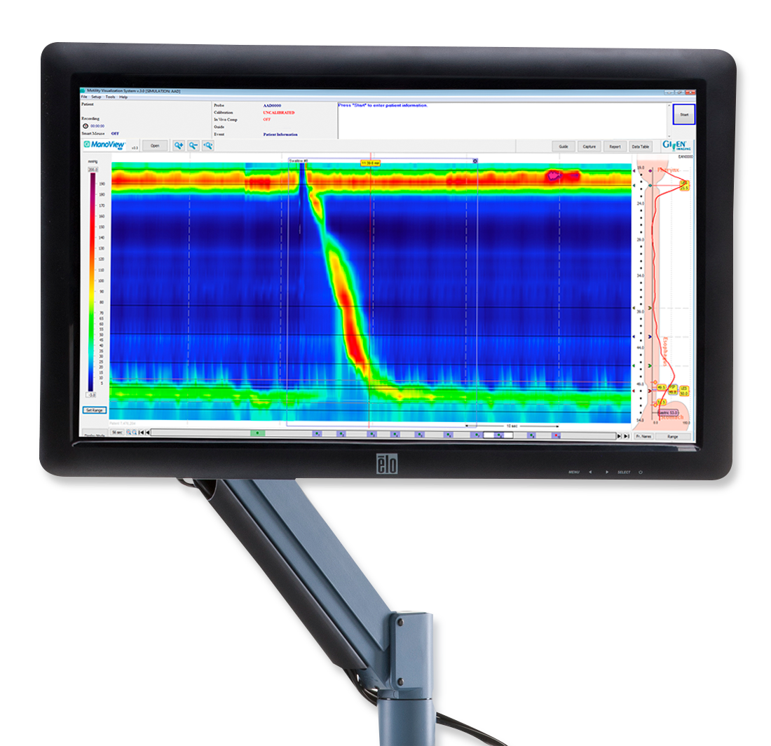 ManoScan™ ESO High Resolution Manometry System